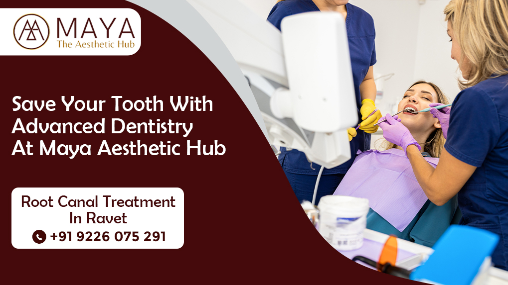  root-canal-treatment-ravet